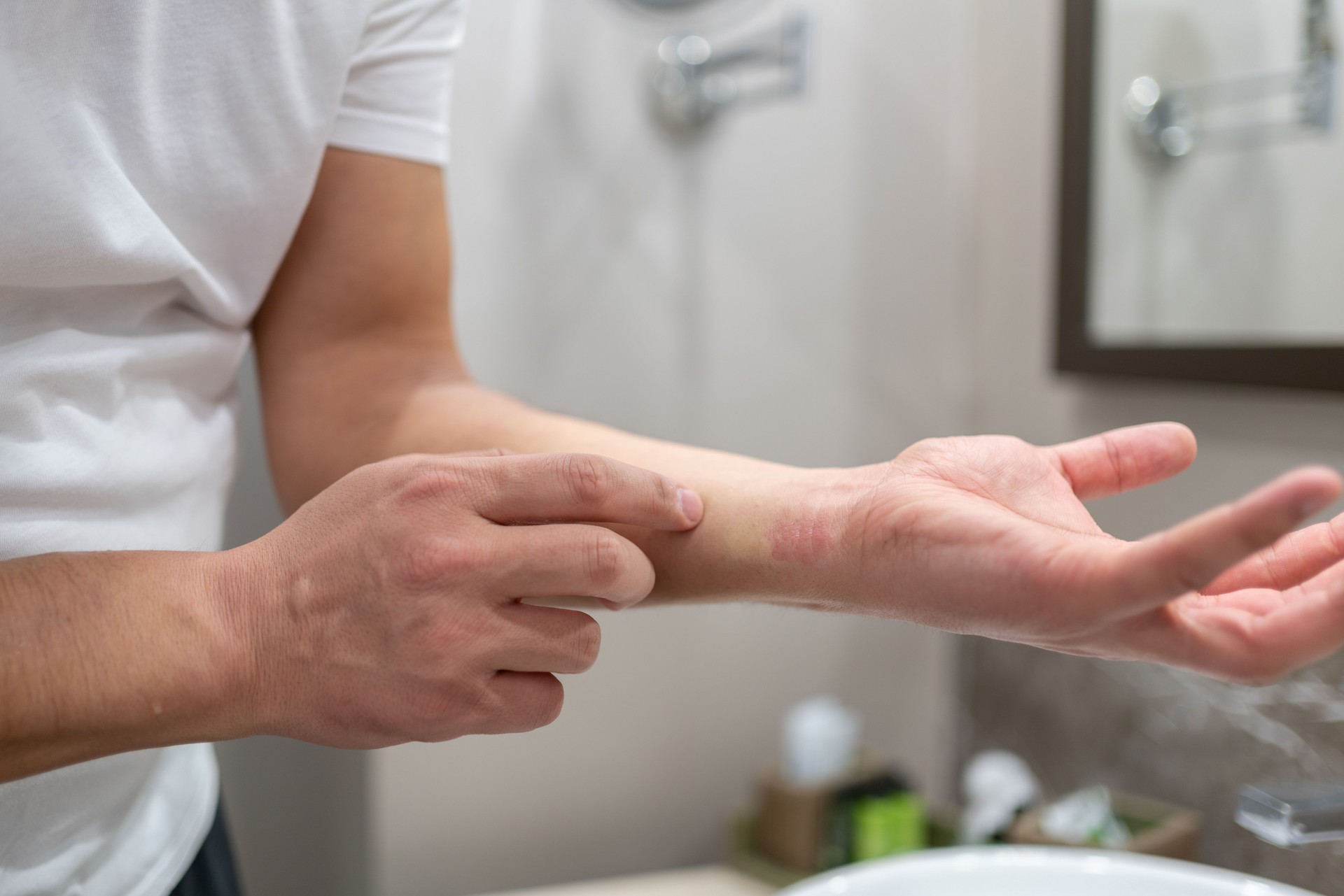 Allergic Reaction From Atopic